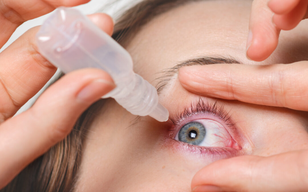 Semana mundial del glaucoma