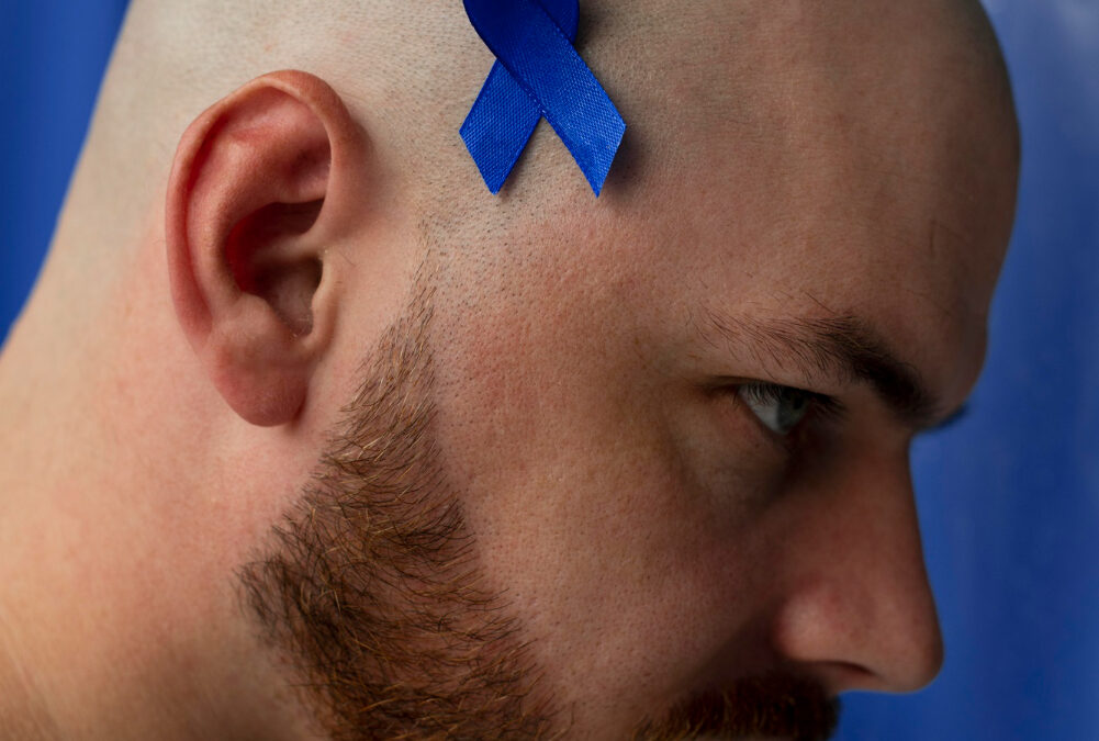 ¿Qué es la epilepsia?